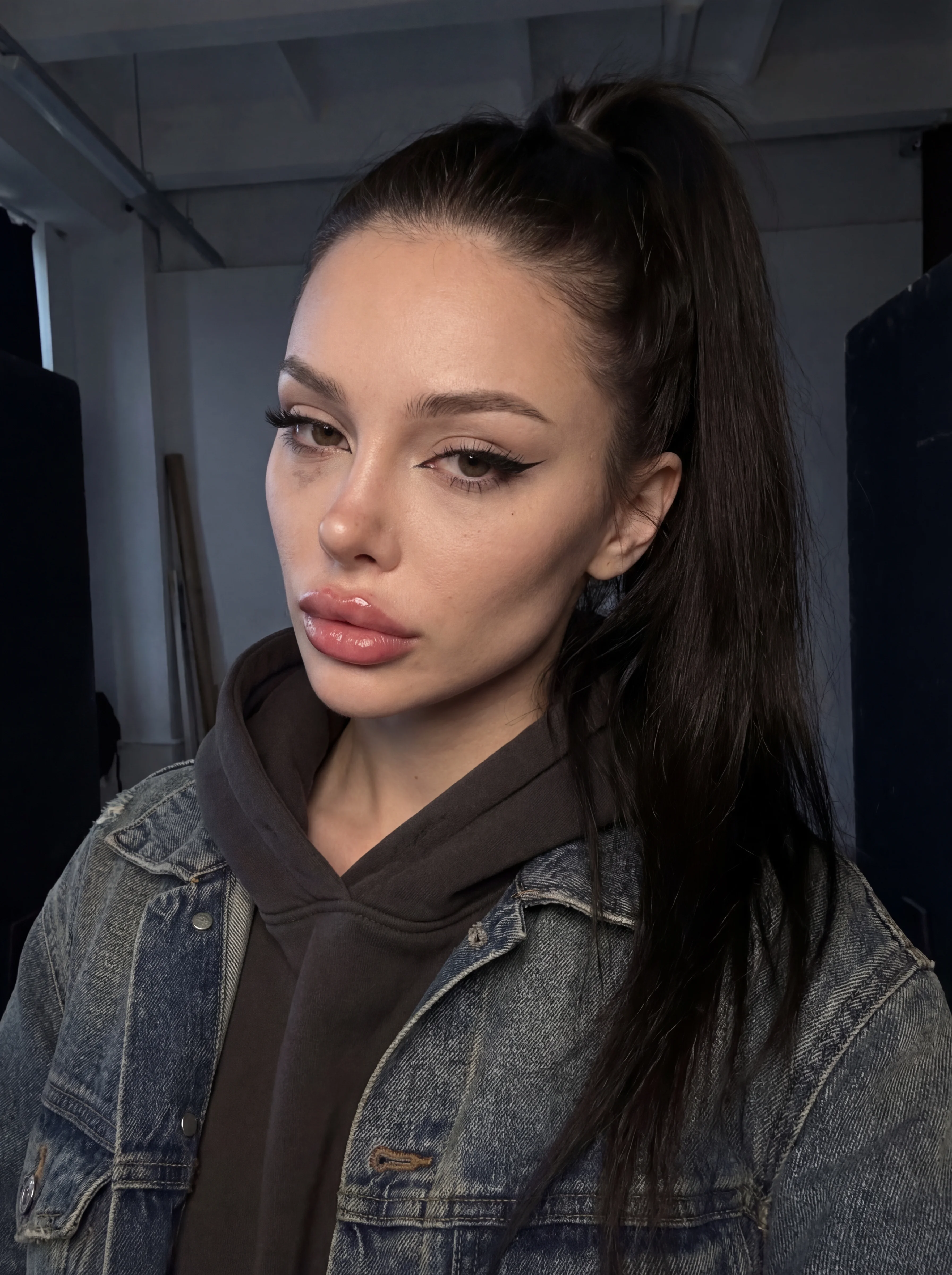 fotomodella di 23 anni. naso rifatto alla francese all’insù, lifting facciale, g